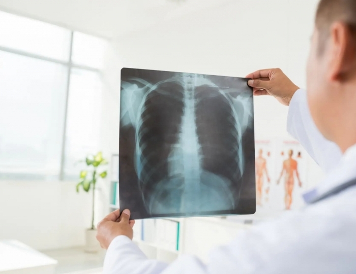 Лечение органов дыхания - Лечебные программы - Санаторий «Славутич»